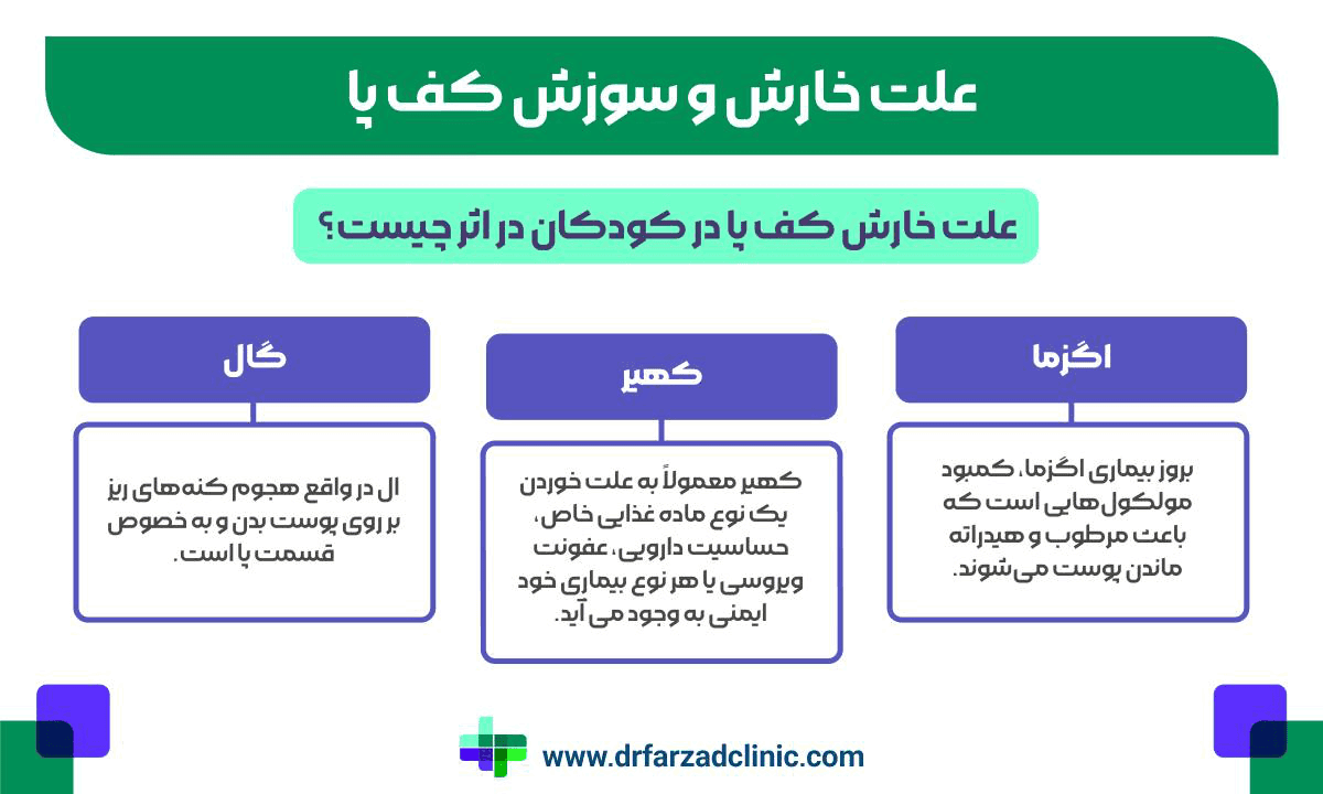 علت خارش و سوزش کف پا